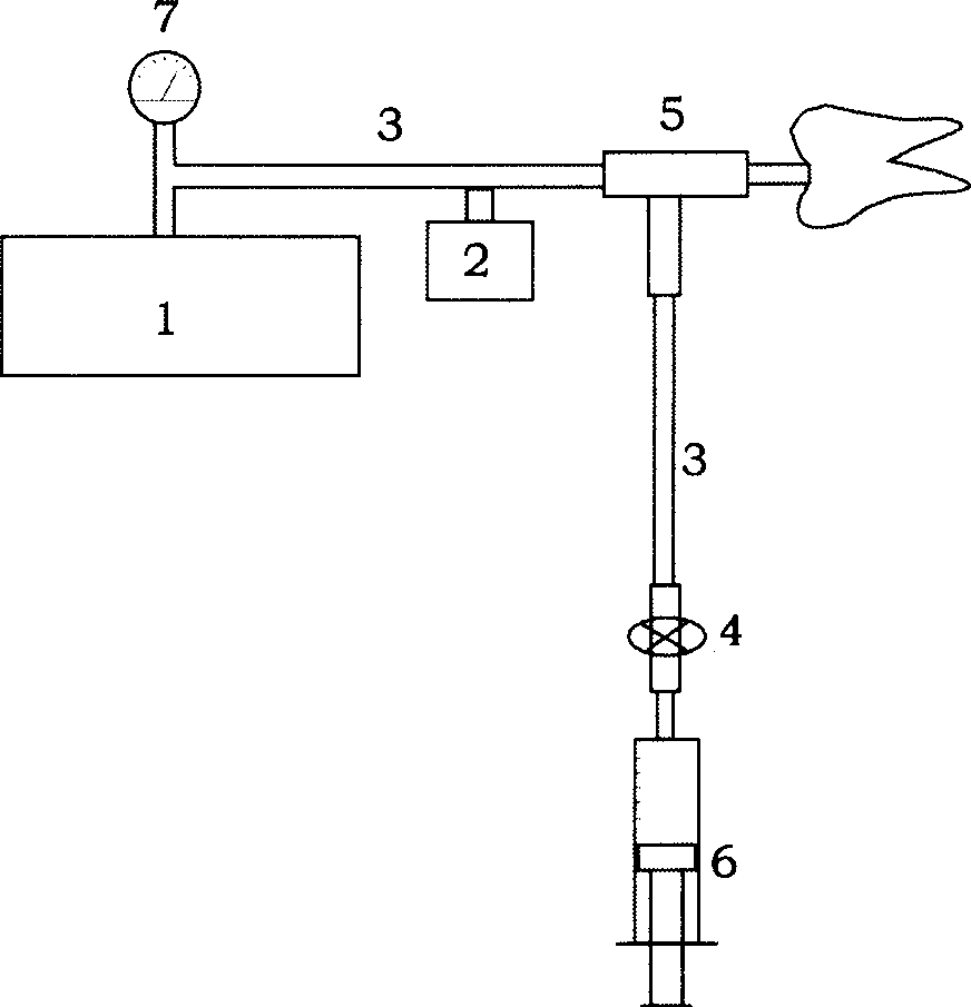 X-ray contrast medium transport device in root-canal