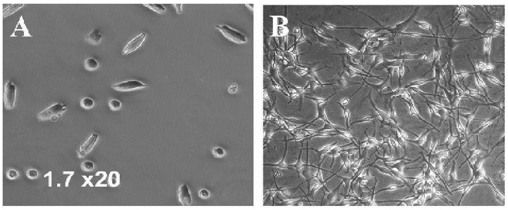 Method for preparing composite membrane for treating leucoderma from autologous follicle melanocytes