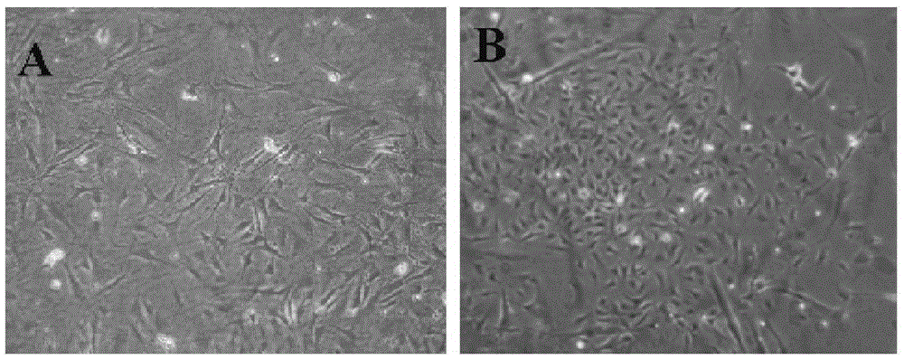 Method for preparing composite membrane for treating leucoderma from autologous follicle melanocytes