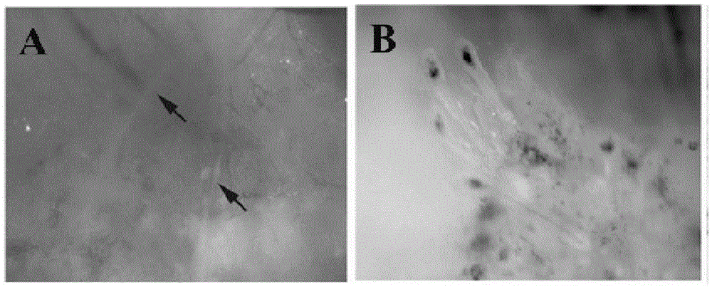 Method for preparing composite membrane for treating leucoderma from autologous follicle melanocytes