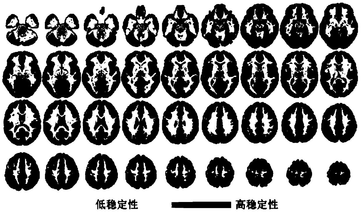 Stability calculation method for brain dynamic function mode