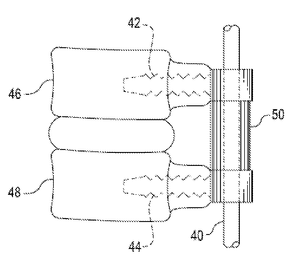 Percutaneous system for dynamic spinal stabilization