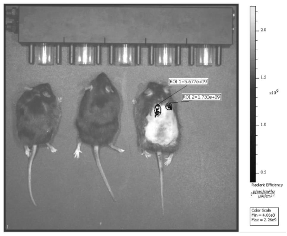 Microneedle capable of controllably releasing medicine and preparation method of microneedle