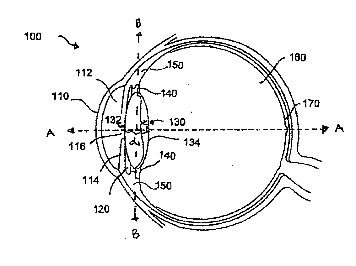 Method and system for adjusting the refractive power of an implanted intraocular lens