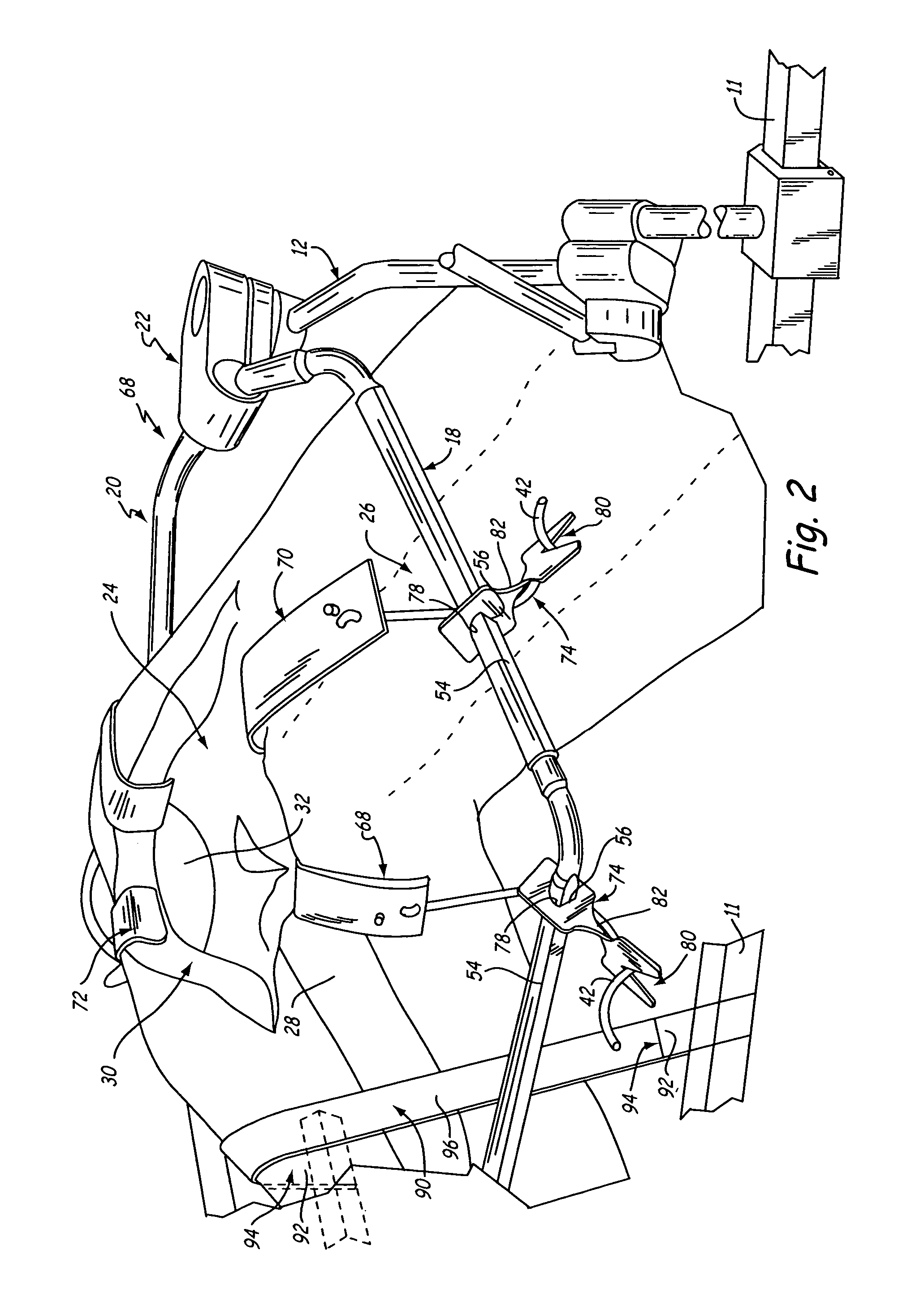 Method for knee-joint surgery