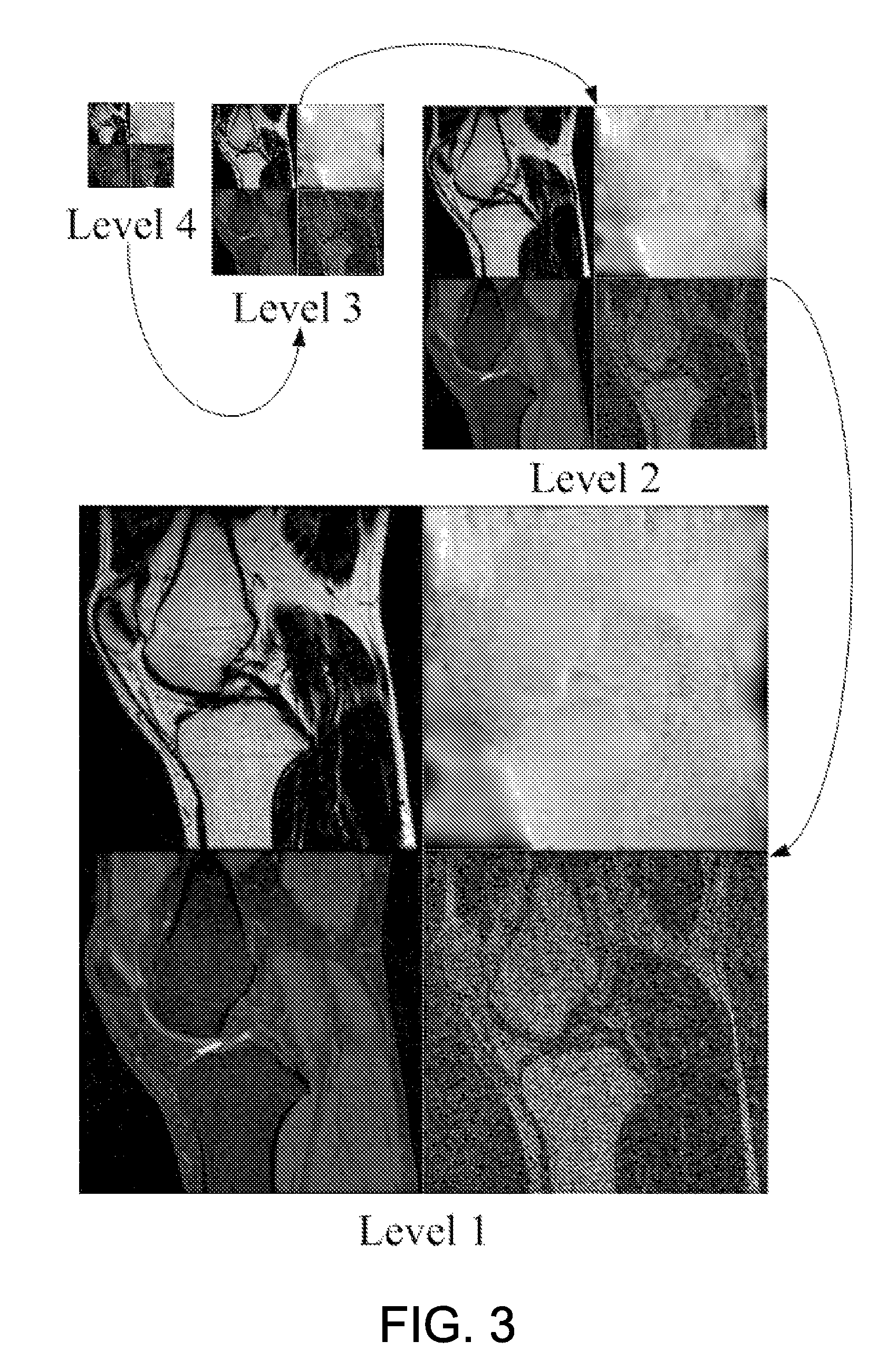 Magnetic resonance field map estimation for species separation