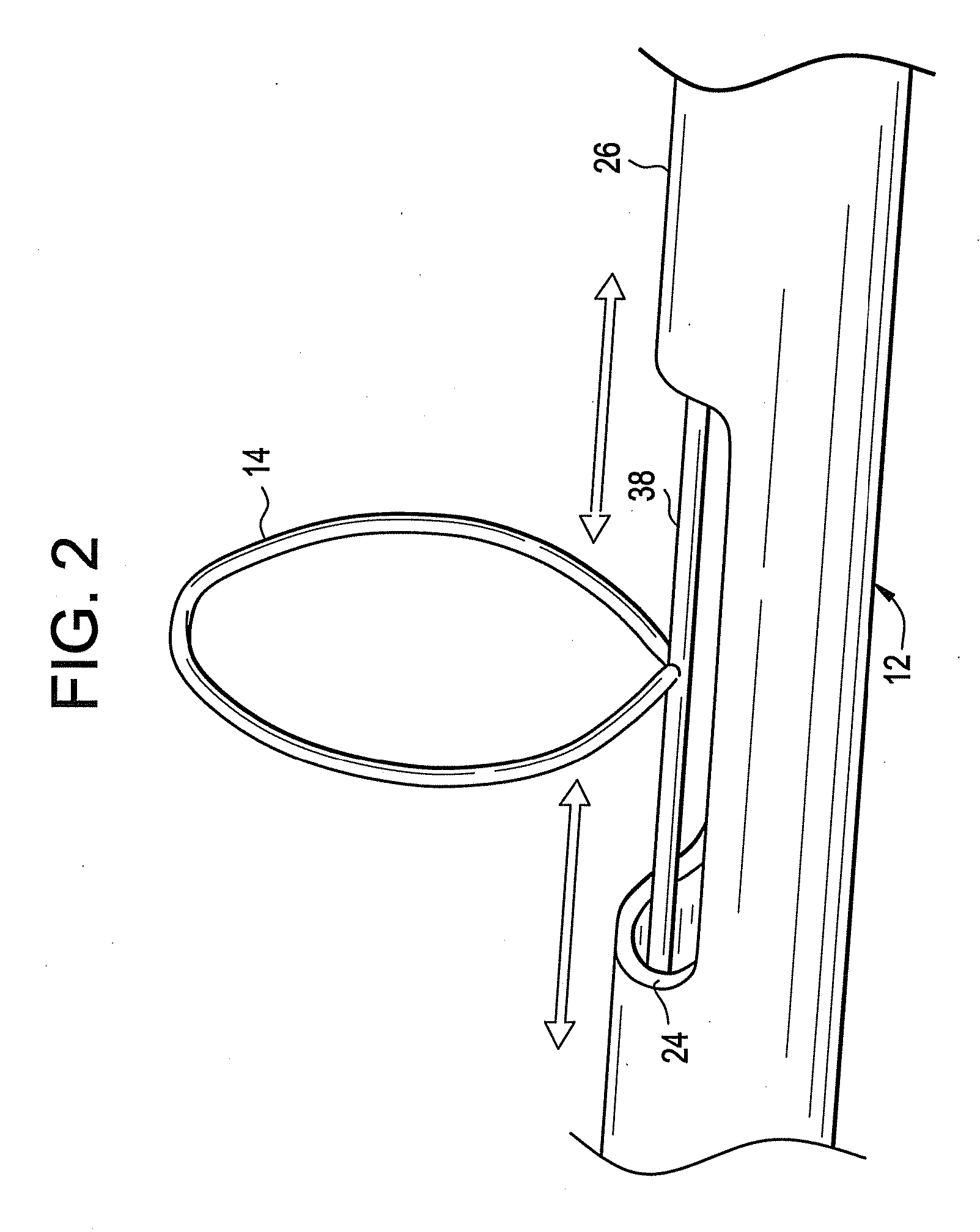 Filter retrieval catheter system, and methods