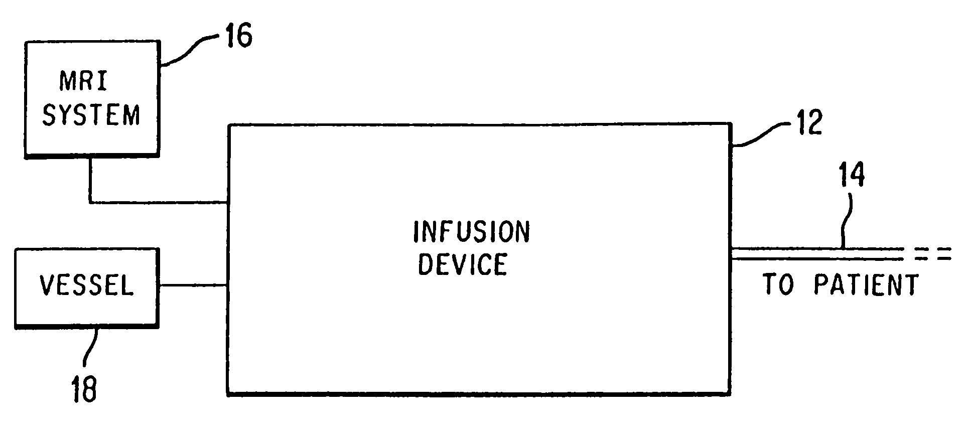 Method and apparatus for magnetic resonance imaging of arteries using a magnetic resonance contrast agent