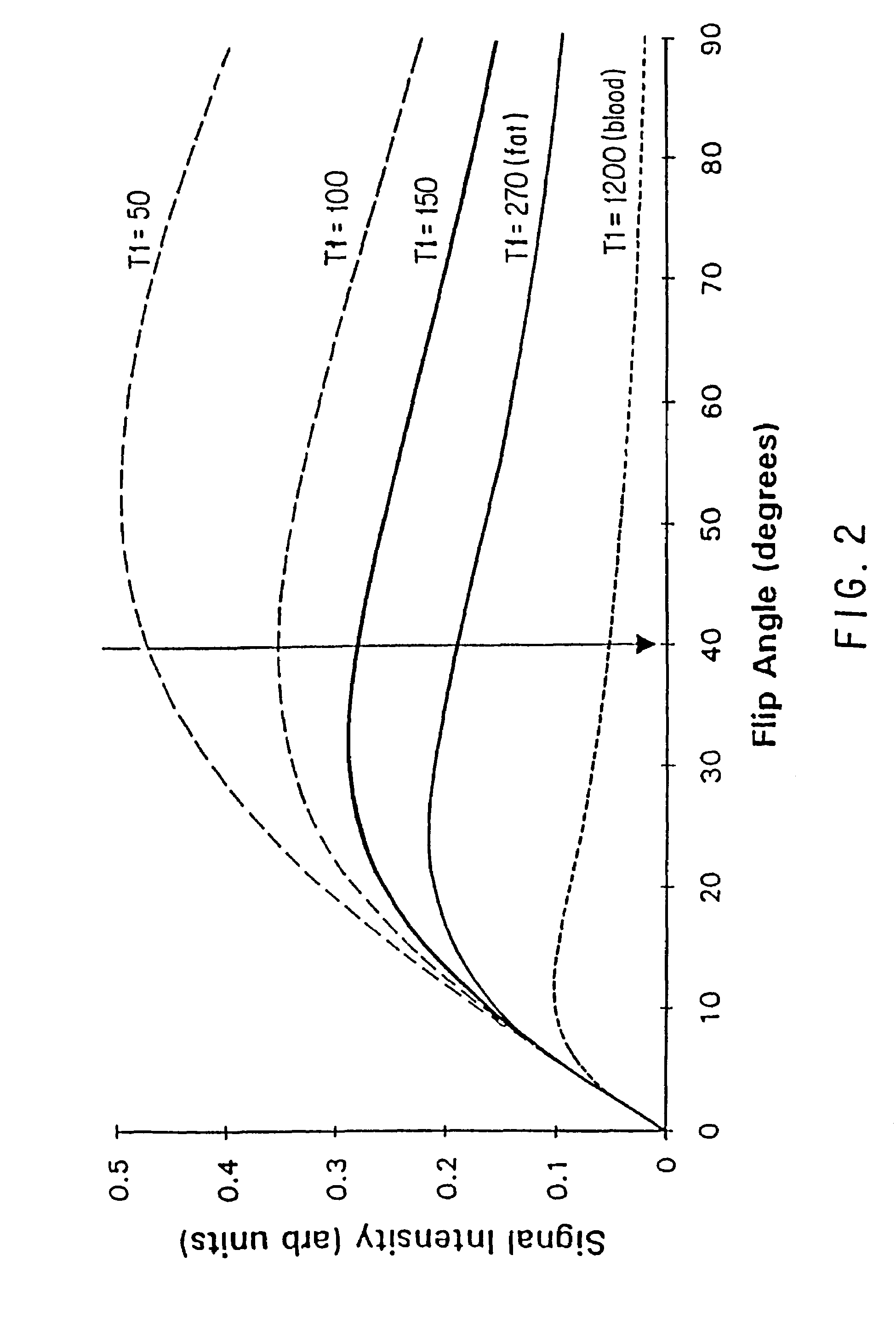 Method and apparatus for magnetic resonance imaging of arteries using a magnetic resonance contrast agent