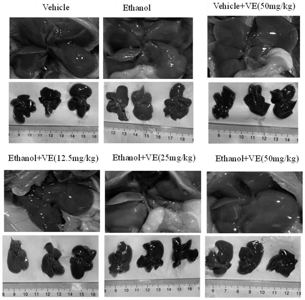 Application of verbenin in medicine for treating alcoholic liver injury