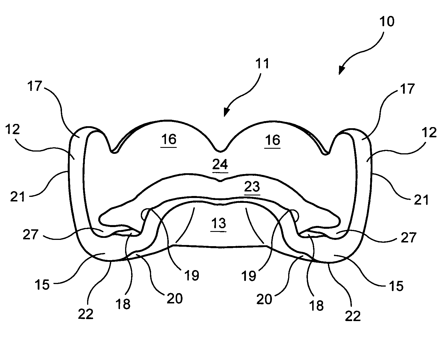 Mouthguard