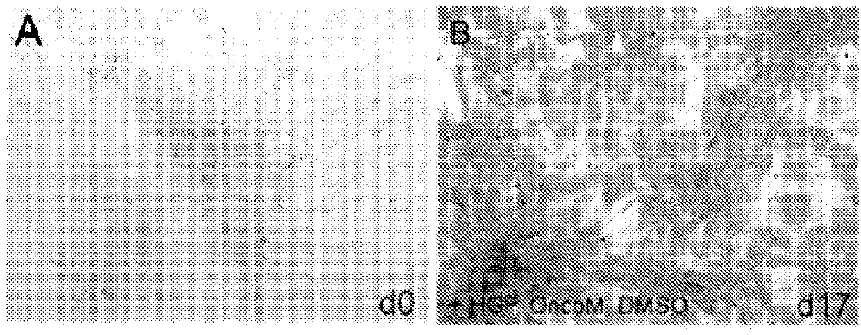 Adipose derived adult stem cells in hepatic regeneration