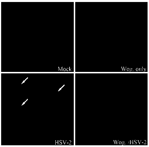 Application of wogonin in preparing medicine for resisting herpes simplex virus