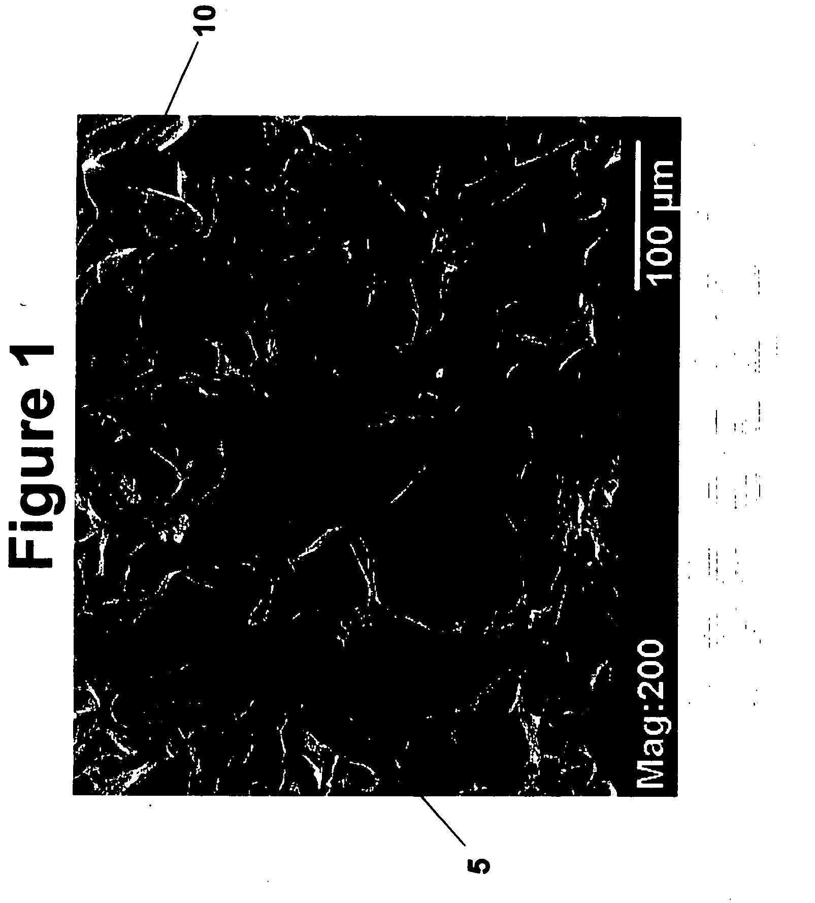 Tissue scaffolds for use in muscoloskeletal repairs