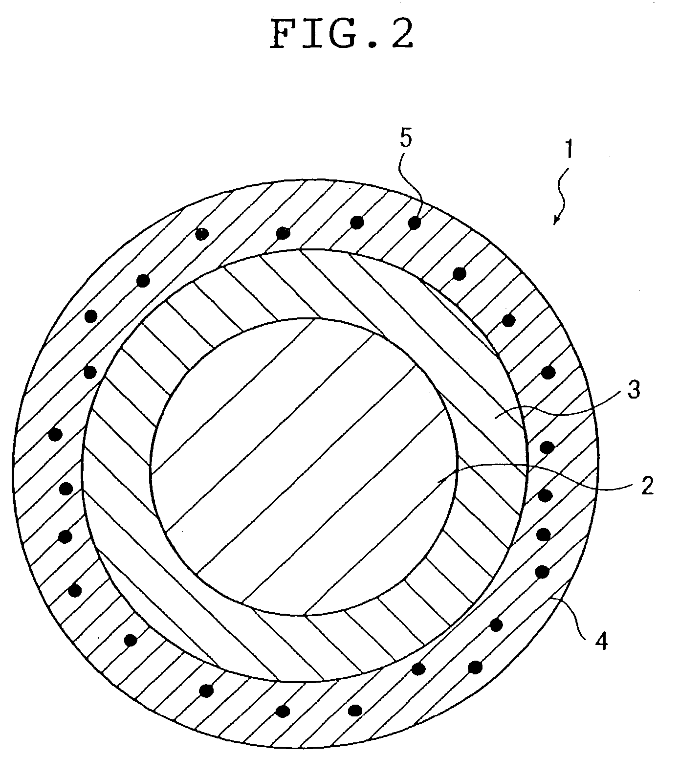 Stent