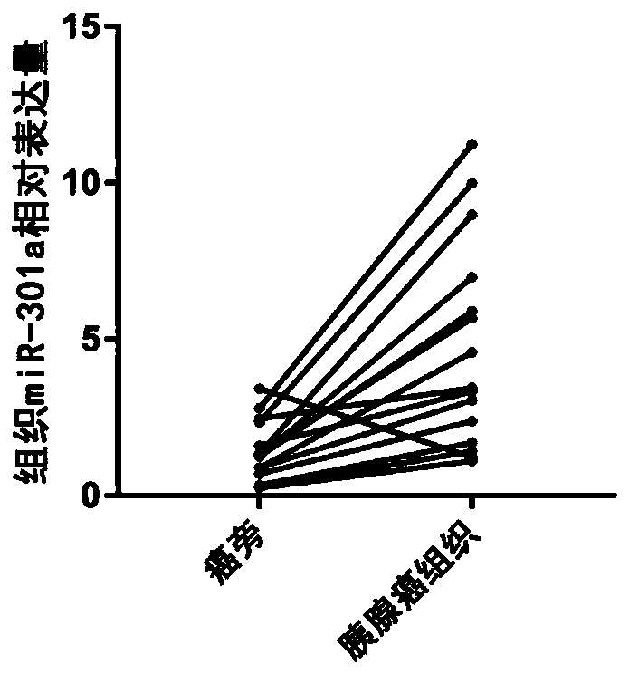 Serum miRNA marker and application of serum miRNA marker in early diagnosis for pancreatic cancer induced by pancreatitis