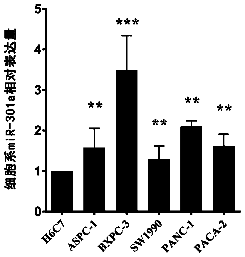 Serum miRNA marker and application of serum miRNA marker in early diagnosis for pancreatic cancer induced by pancreatitis