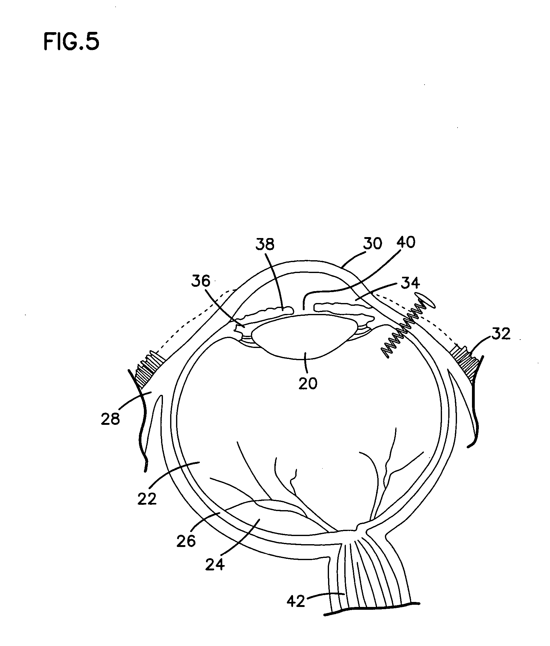 Medical devices and methods for producing the same