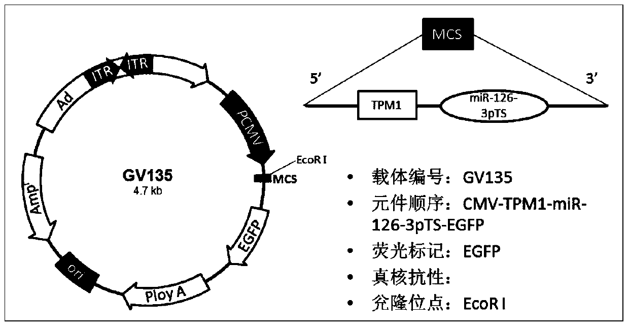 A kind of adenovirus vector and application thereof for specifically inhibiting proliferation and migration of smooth muscle cells