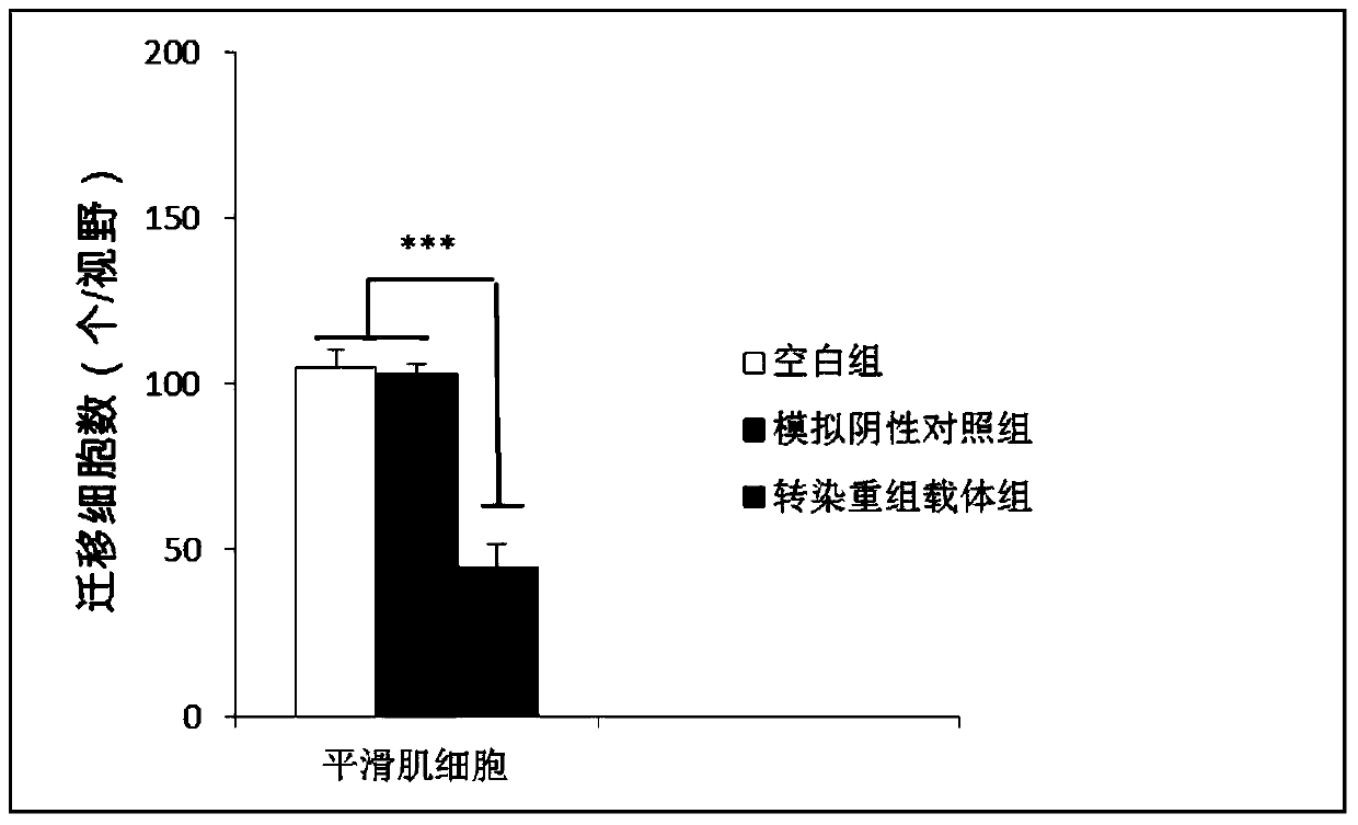 A kind of adenovirus vector and application thereof for specifically inhibiting proliferation and migration of smooth muscle cells