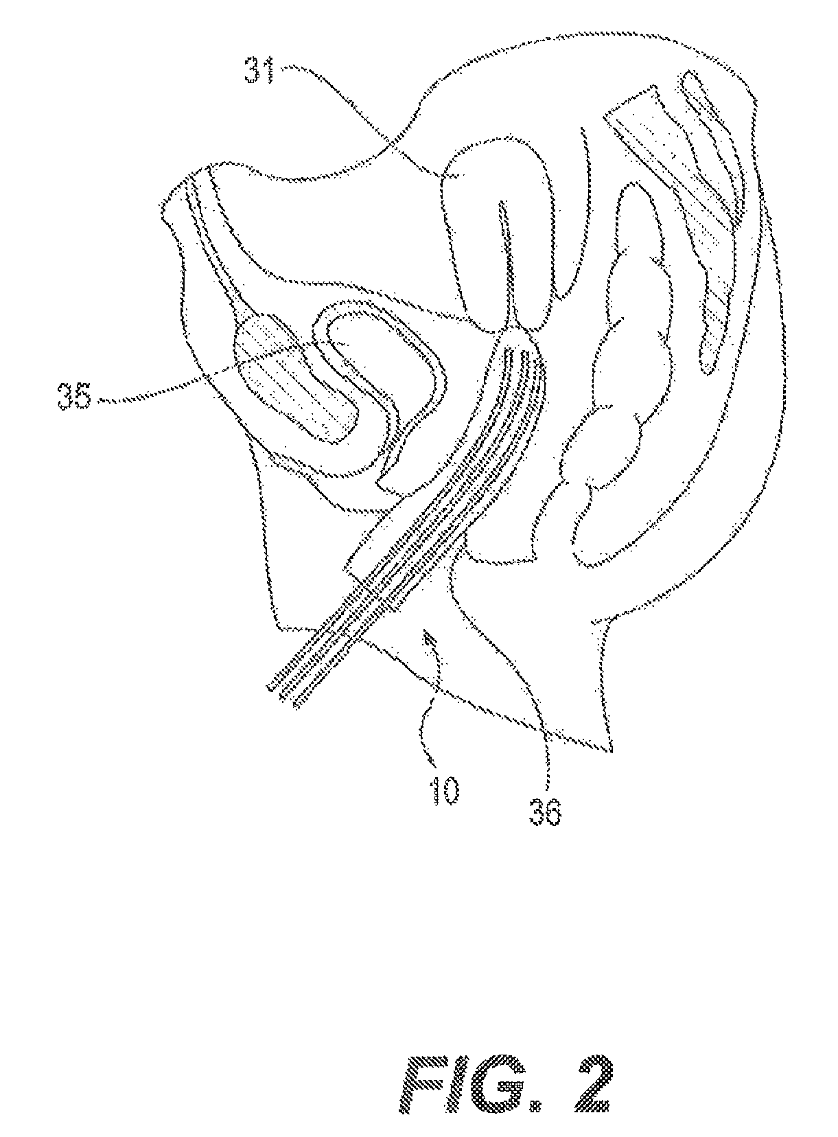 Methods of making a medical applicator