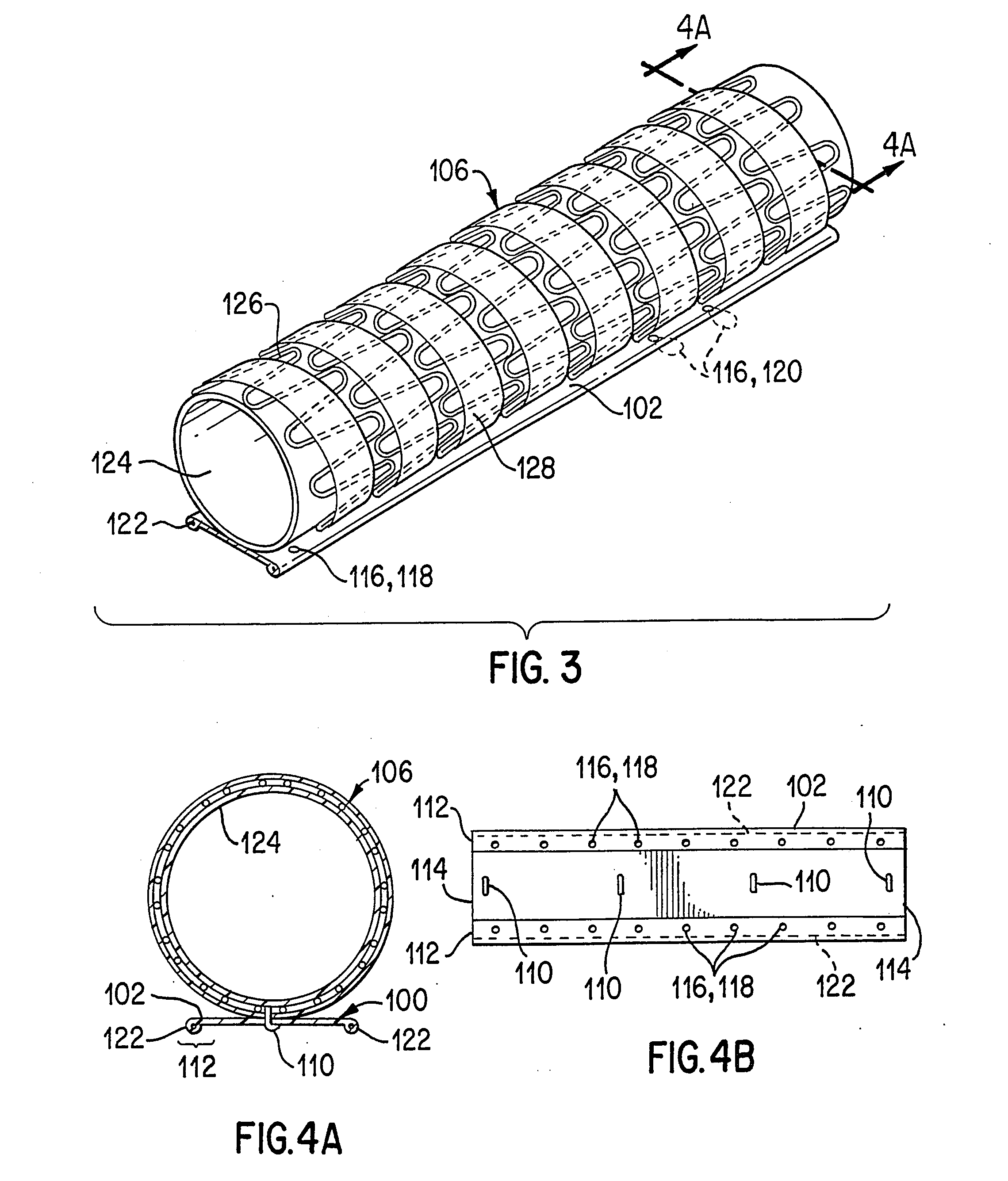 Implant deployment apparatus