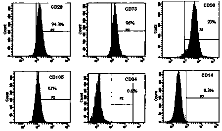 Stem cell preparation for treating primary liver cancer and preparation method thereof