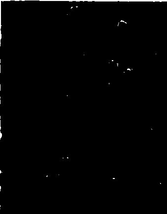 Stem cell preparation for treating primary liver cancer and preparation method thereof