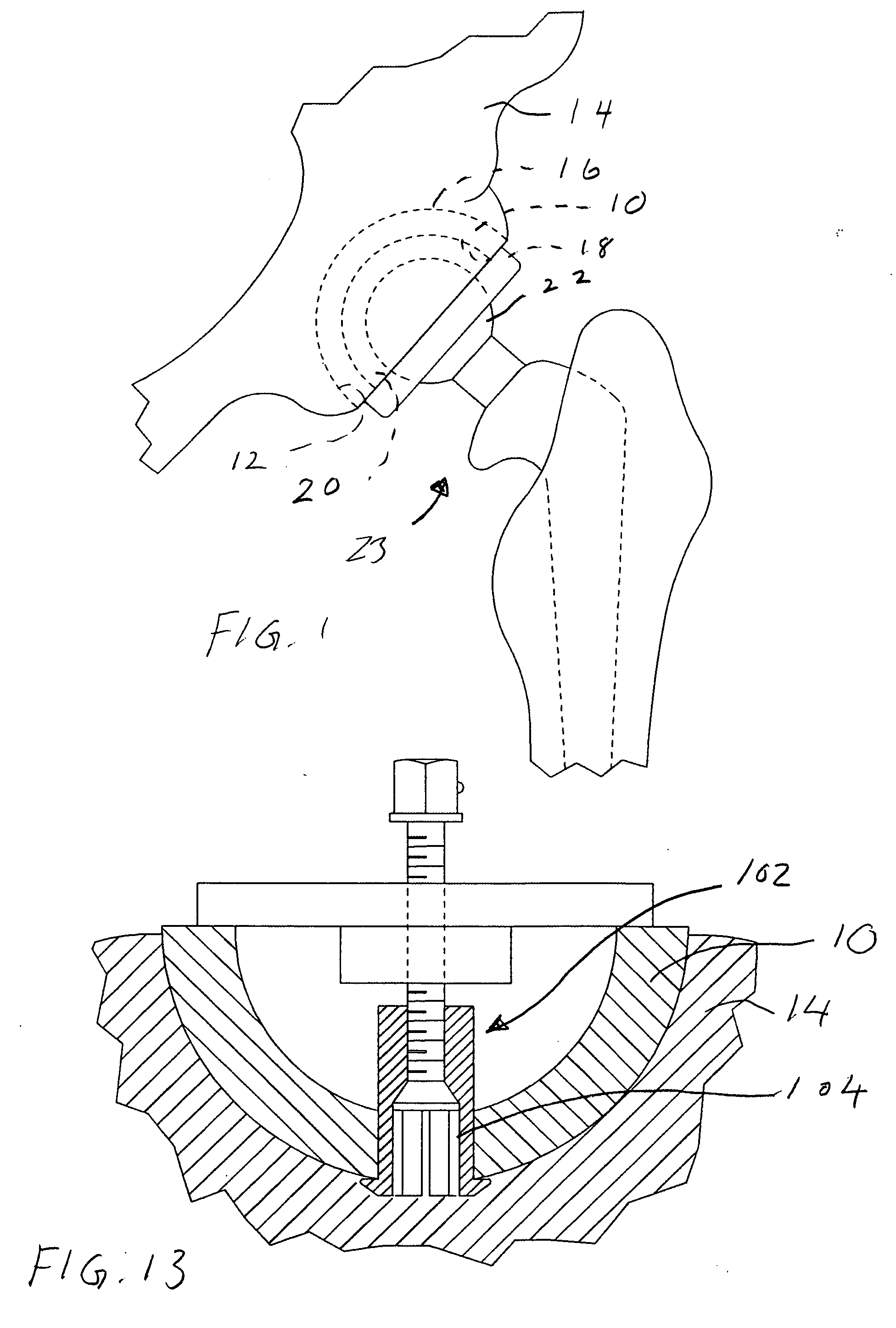 Acetabular shell removal tool