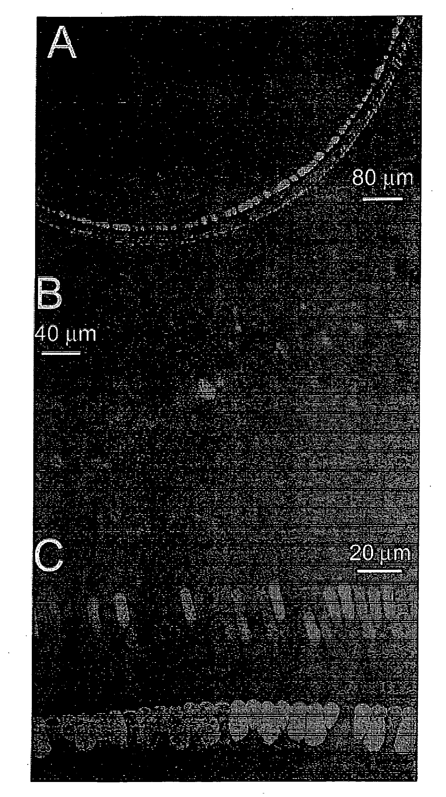 Method of treating or preventing hearing loss