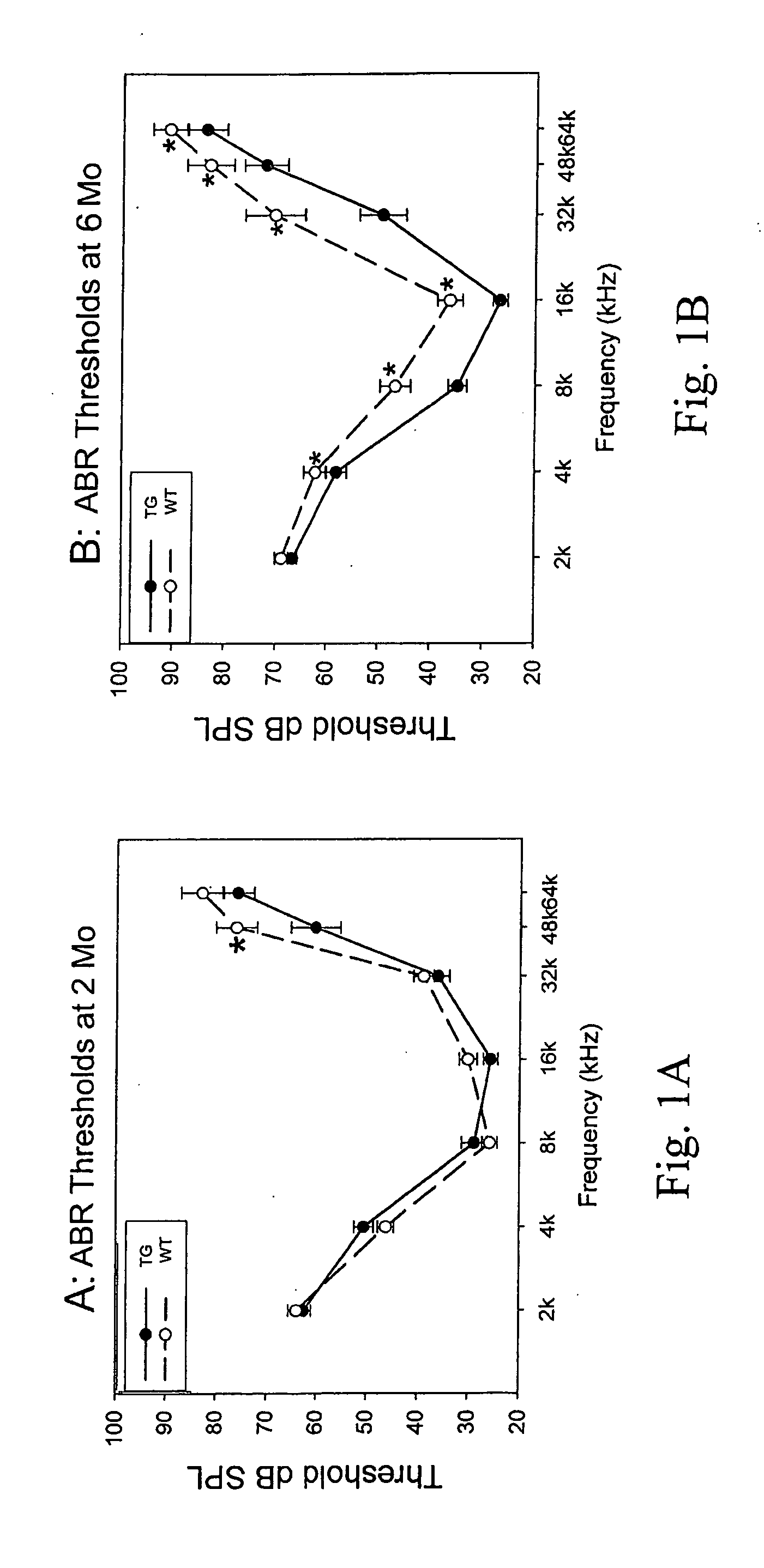 Method of treating or preventing hearing loss