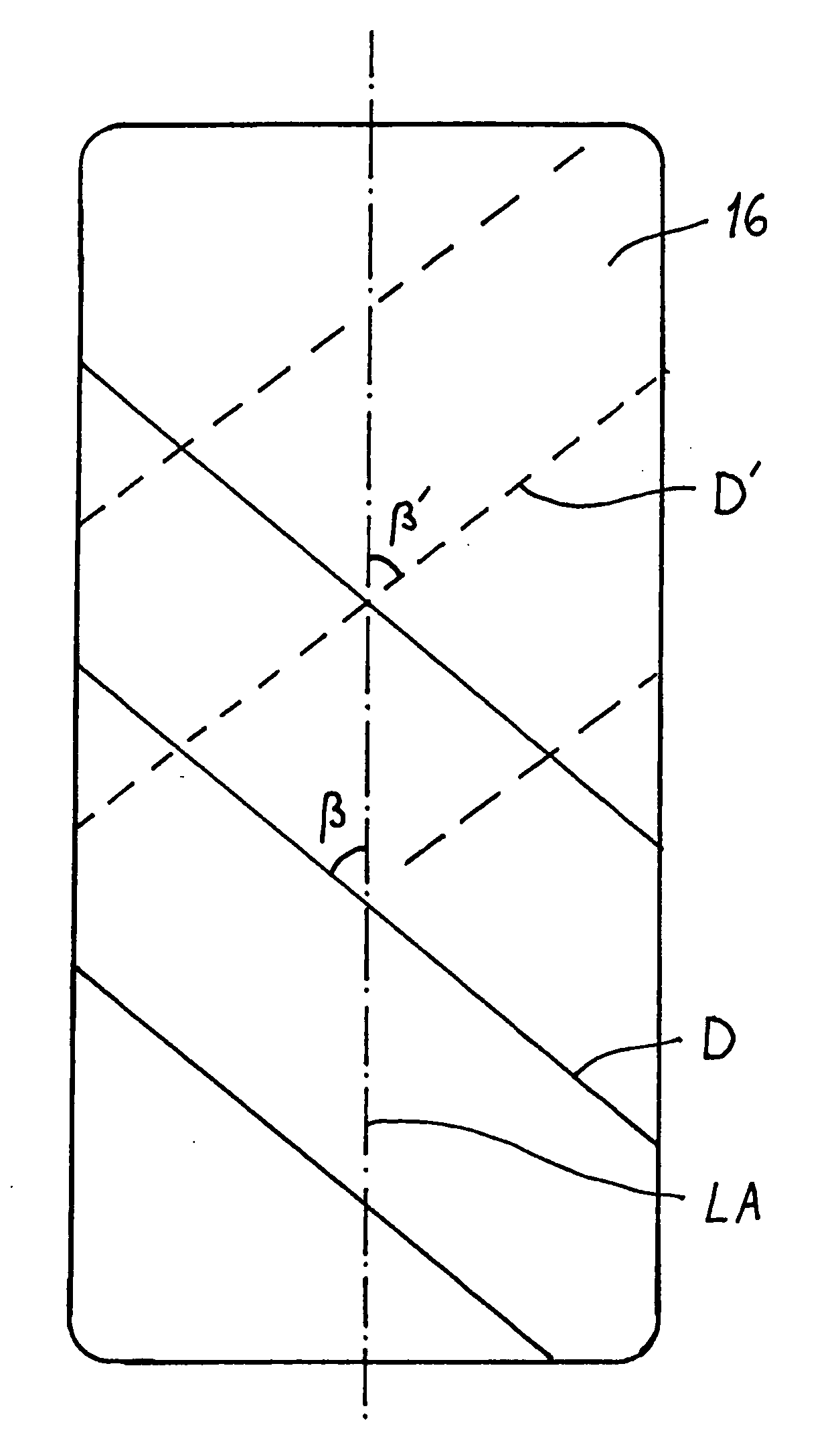 Bioabsorbable, deformable fixation material and implant