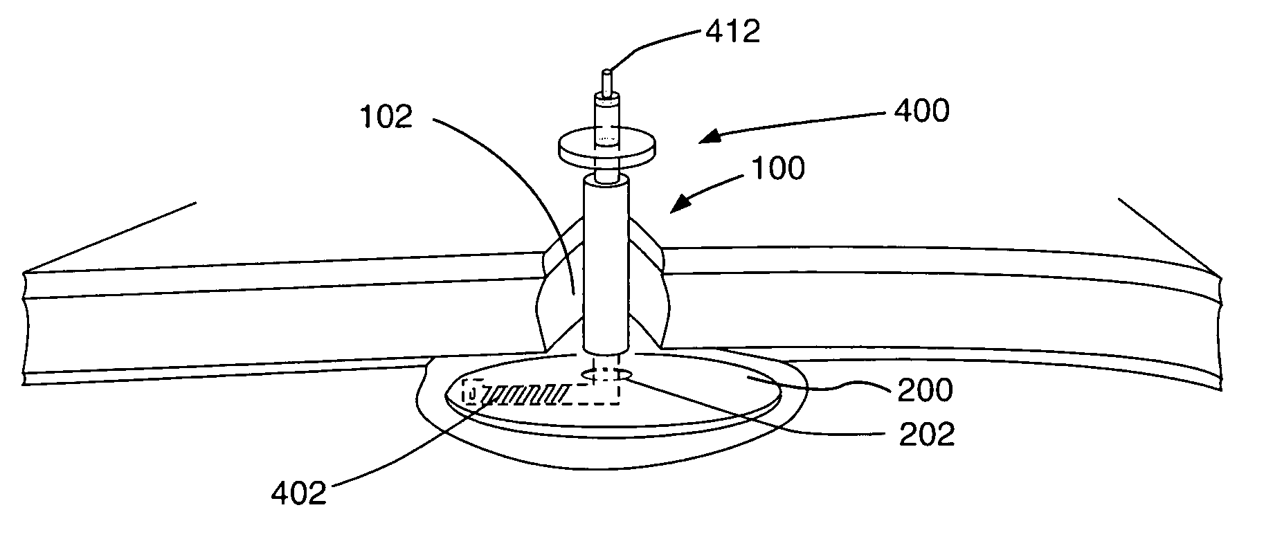 Methods and apparatus for the repair of hernias