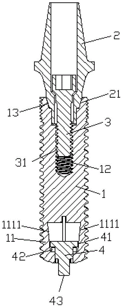 Closed implants with spontaneous elastic expansion