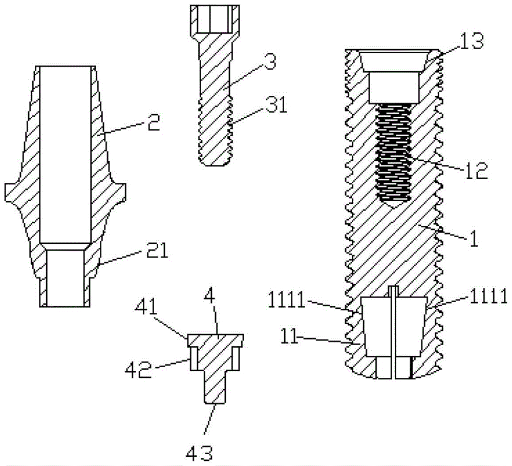 Closed implants with spontaneous elastic expansion