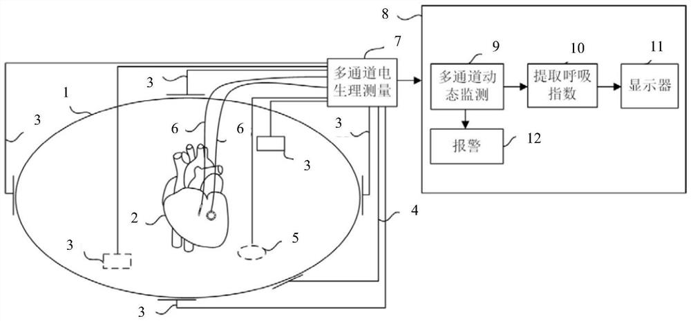 A respiratory index extraction system and working method based on multi-channel dynamic monitoring