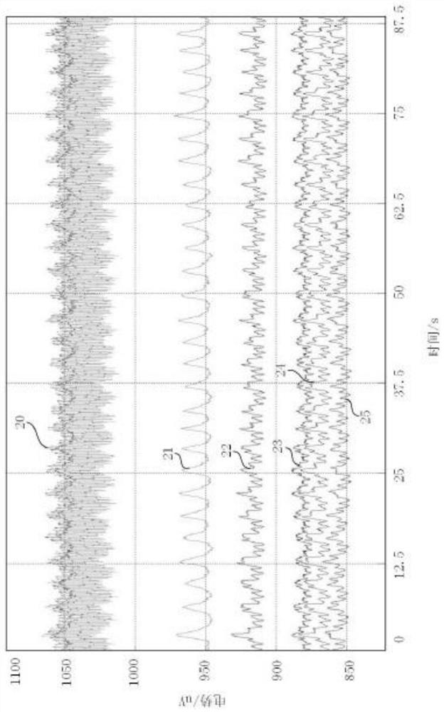 A respiratory index extraction system and working method based on multi-channel dynamic monitoring