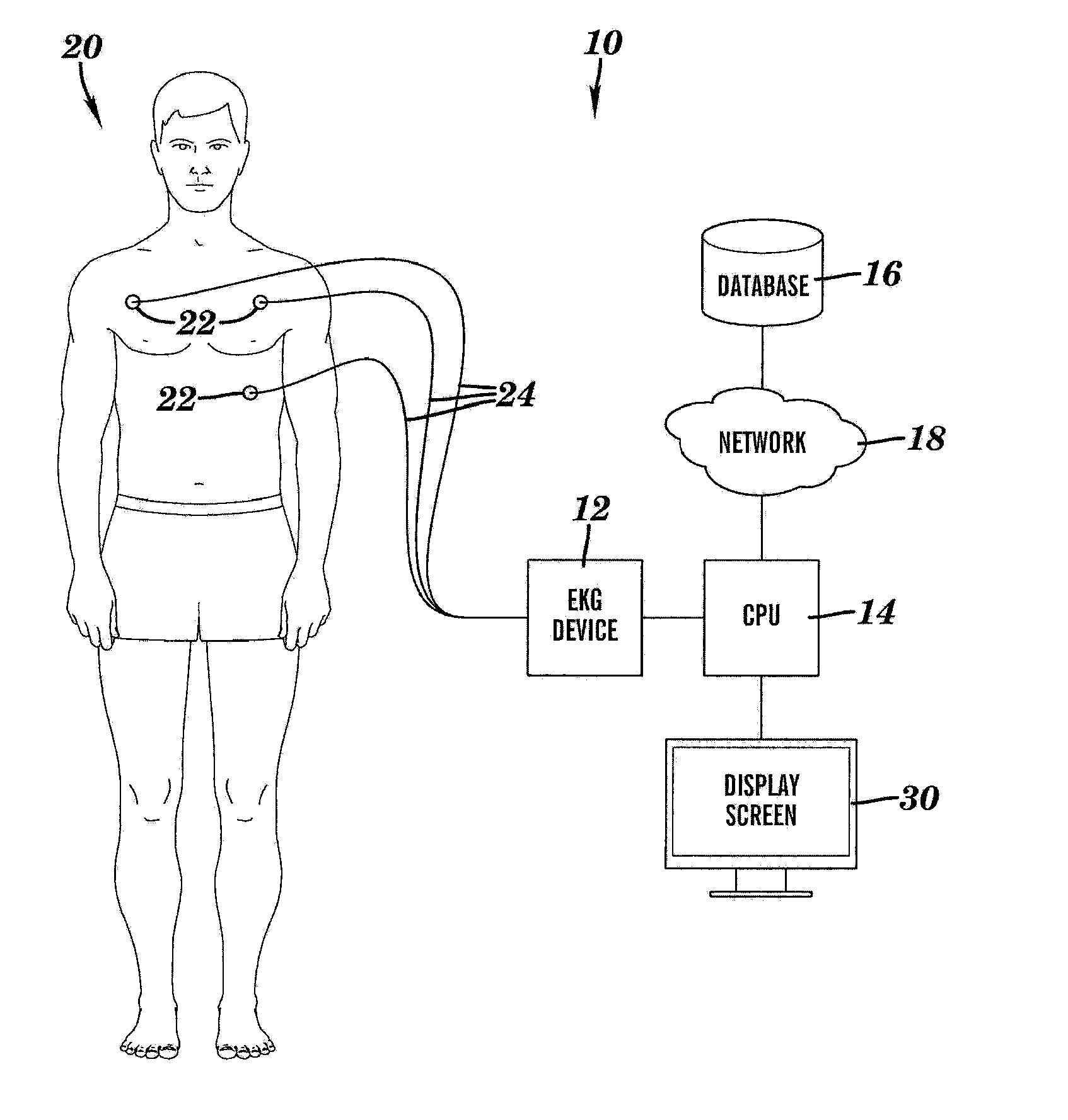 System and method  for inferring disease similarity by shape matching of ECG time series