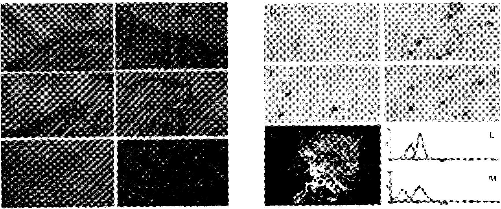 Method for establishing endothelial crossing model for asthmatic serum dendritic cell