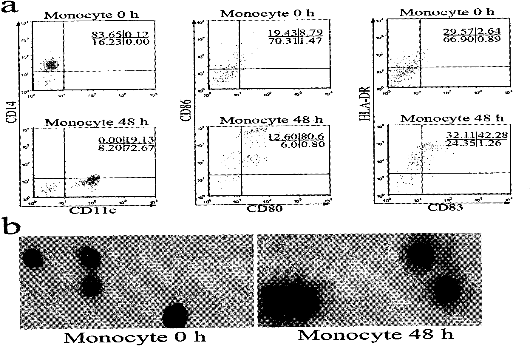 Method for establishing endothelial crossing model for asthmatic serum dendritic cell