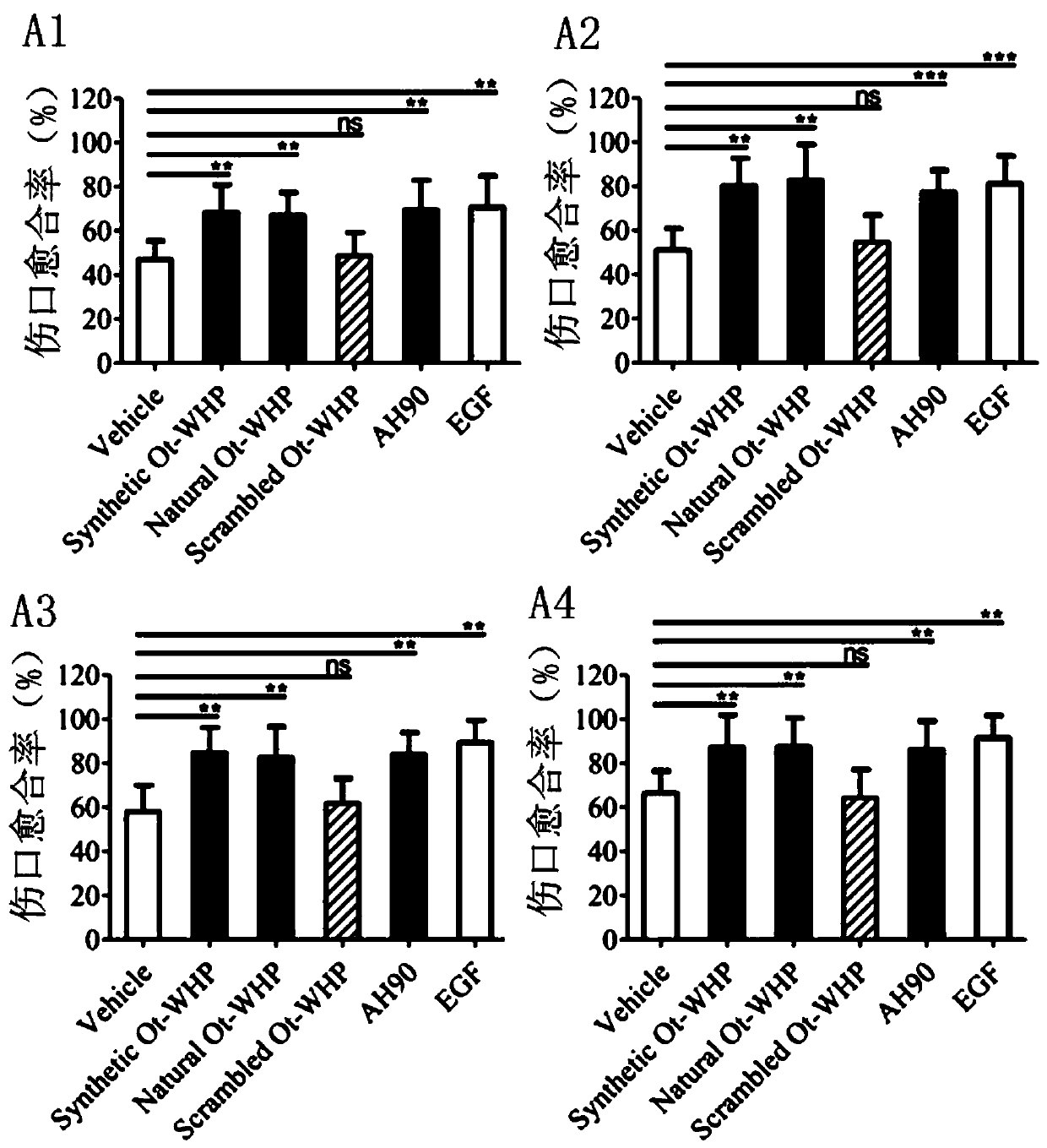 Odorrana tormota immunomodulating peptide and application thereof