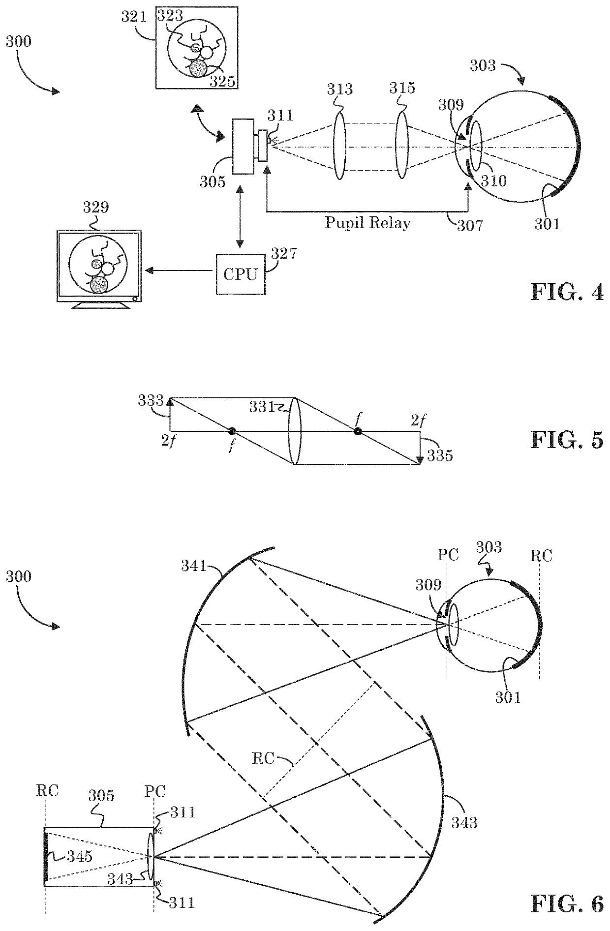 Low cost fundus imager with integrated pupil camera for alignment aid