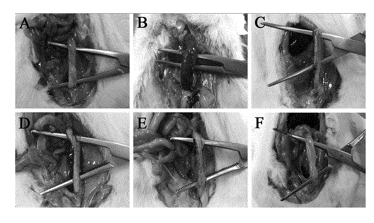 Composition for preventing or treating ischemic enteritis containing DNA fragment mixture isolated from sperm or testis of fish