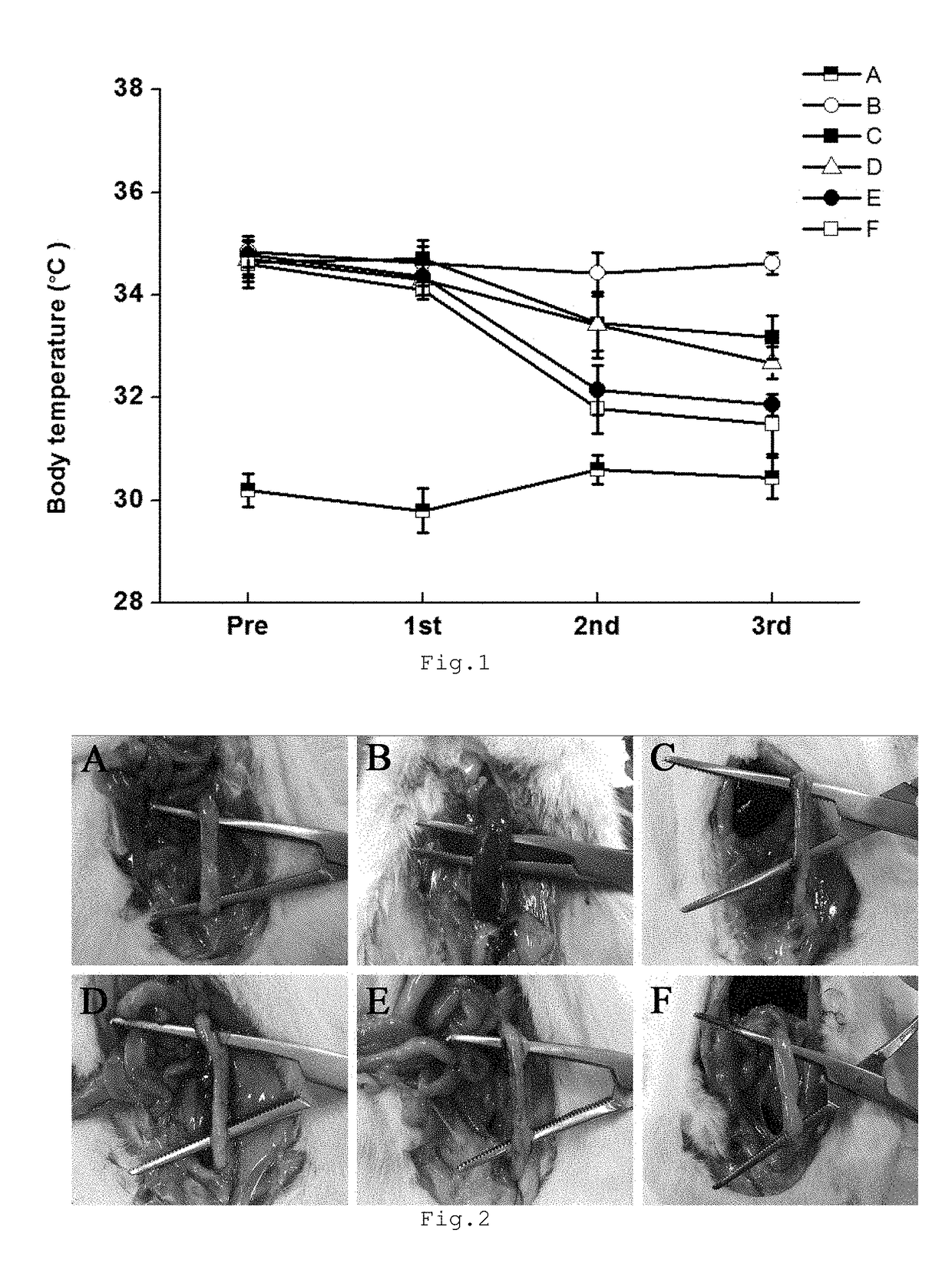 Composition for preventing or treating ischemic enteritis containing DNA fragment mixture isolated from sperm or testis of fish