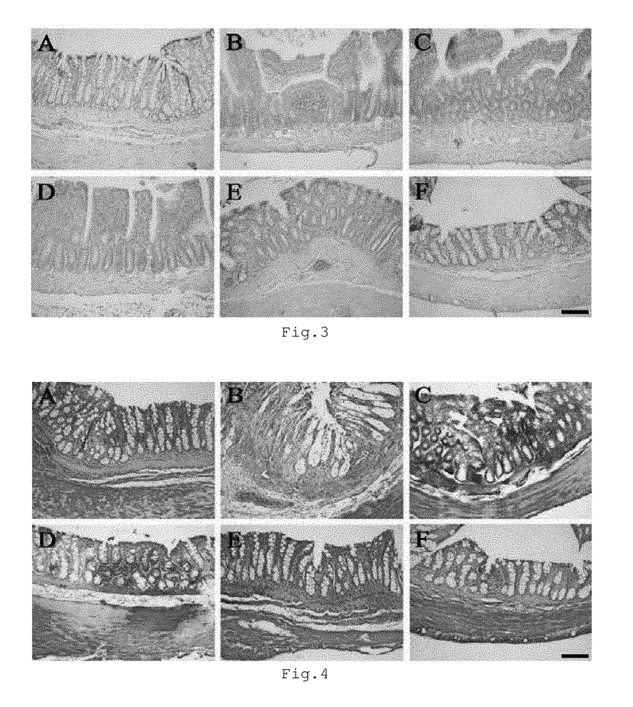 Composition for preventing or treating ischemic enteritis containing DNA fragment mixture isolated from sperm or testis of fish