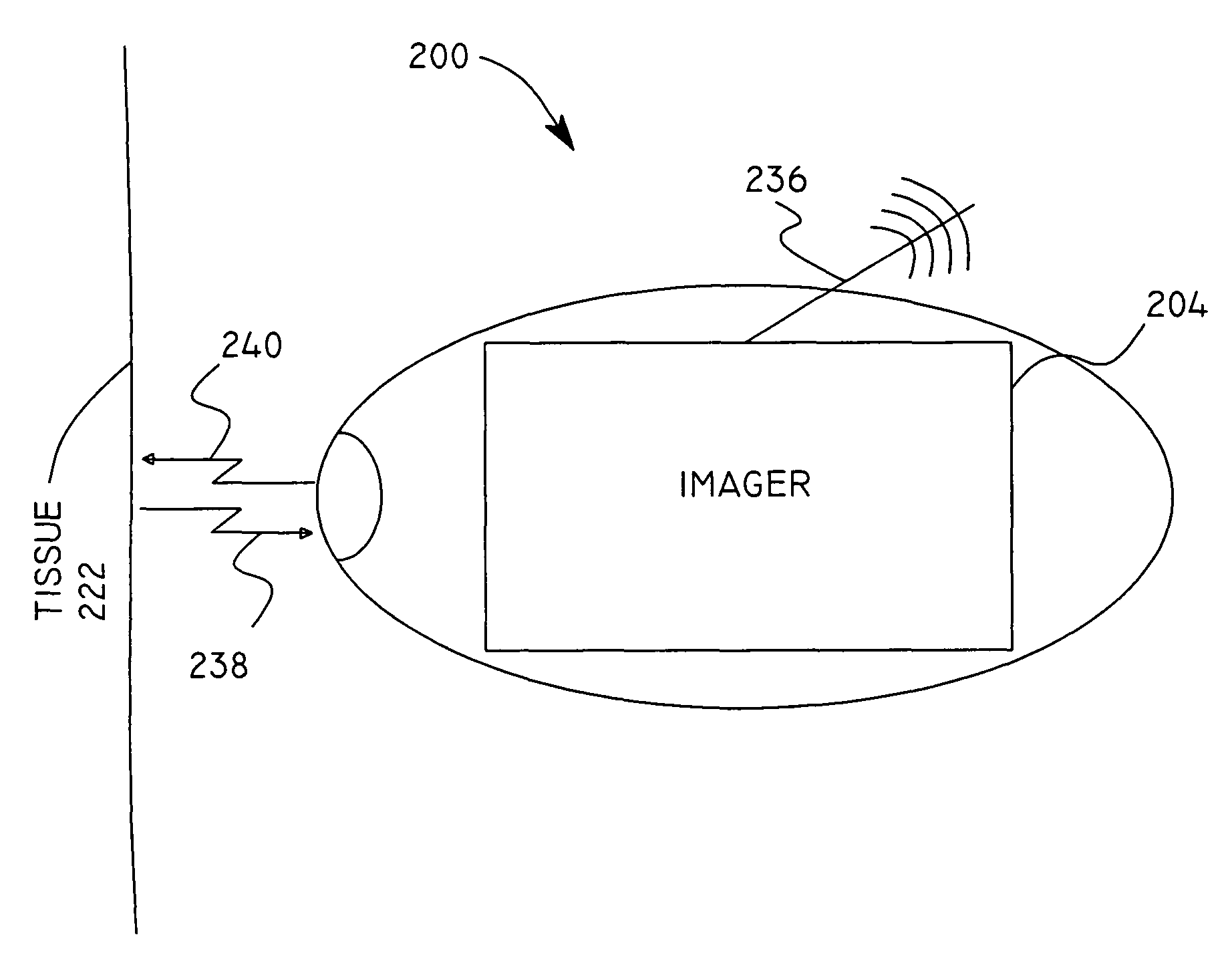 Micro-scale compact device for in vivo medical diagnosis combining optical imaging and point fluorescence spectroscopy