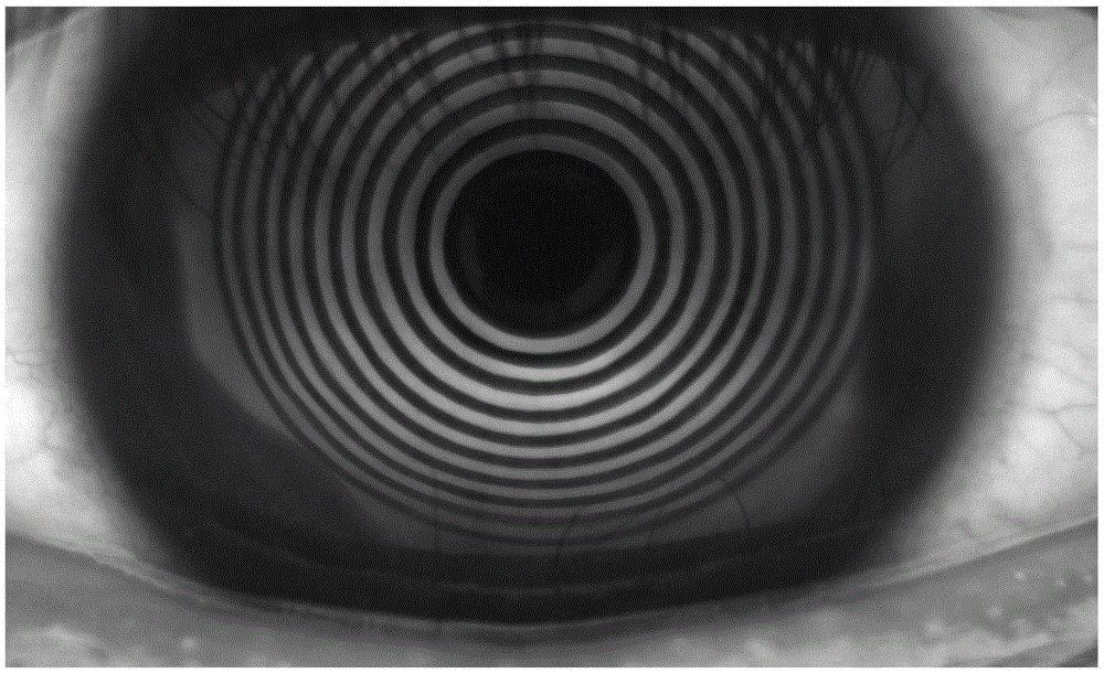 A non-contact tear film breakup time measuring device and method