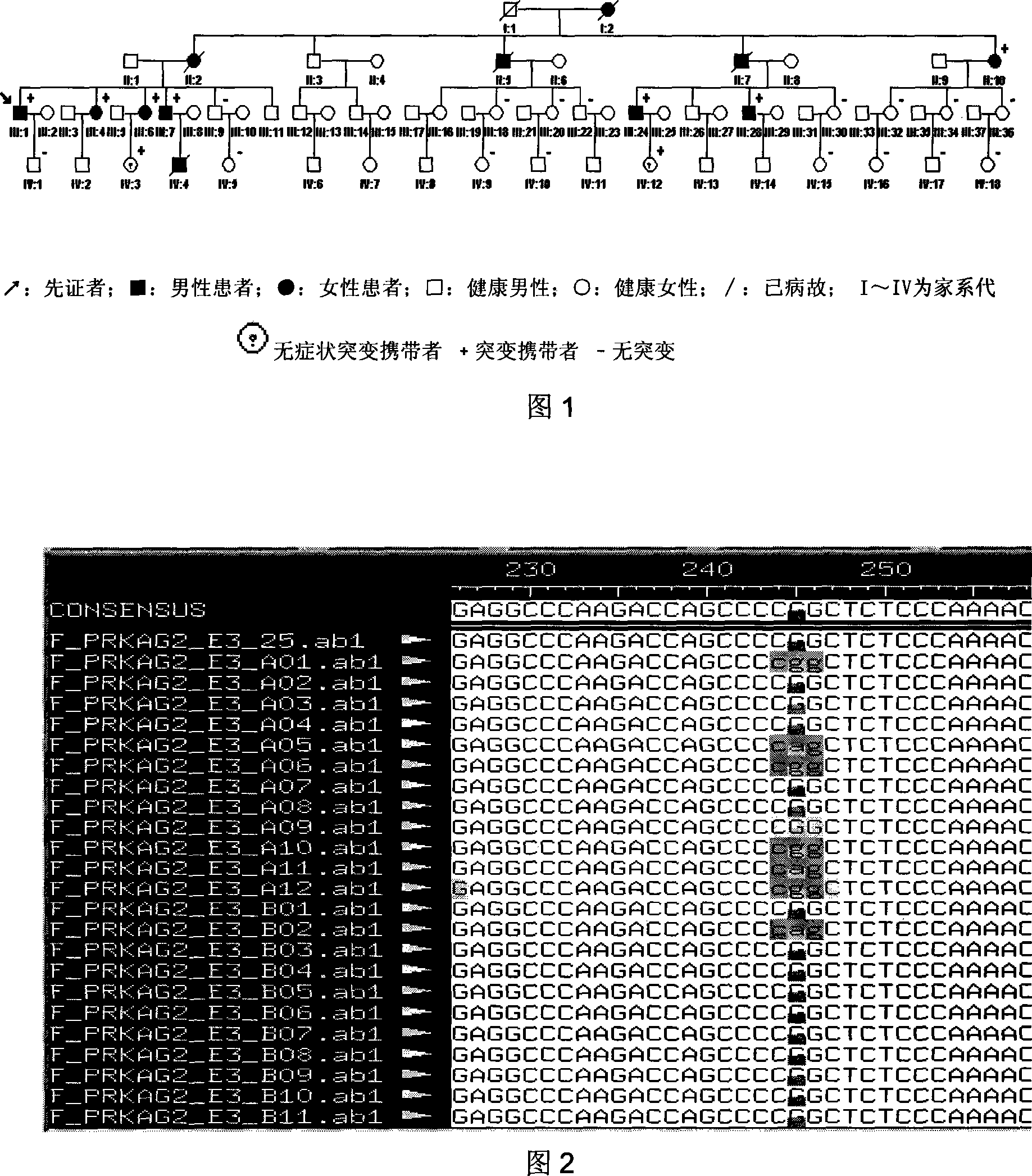 Hypertrophic type cardiomyopathy PRKAG2 gene mutation and detecting method thereof