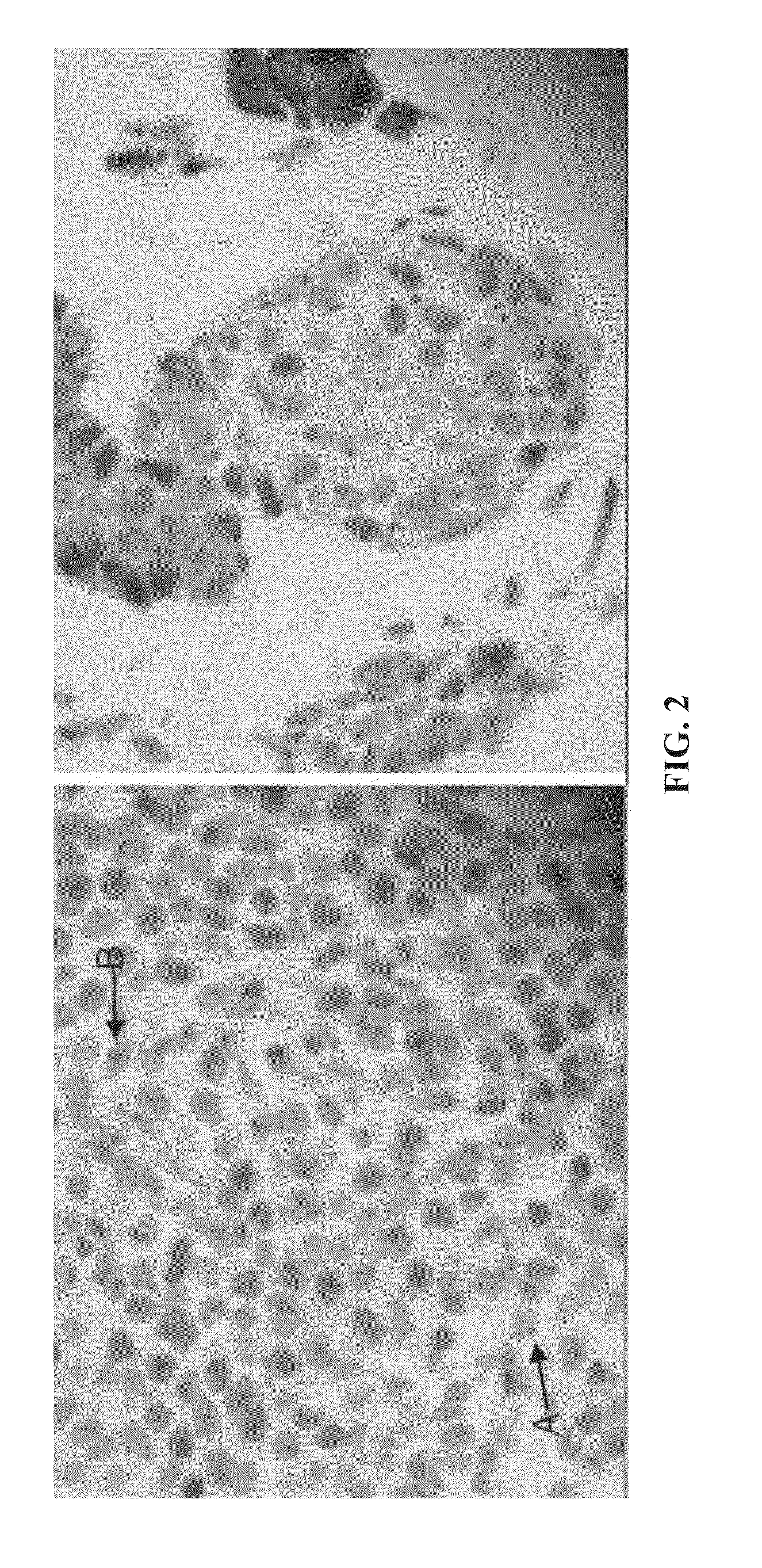 Method for diagnosing melanocytic proliferations