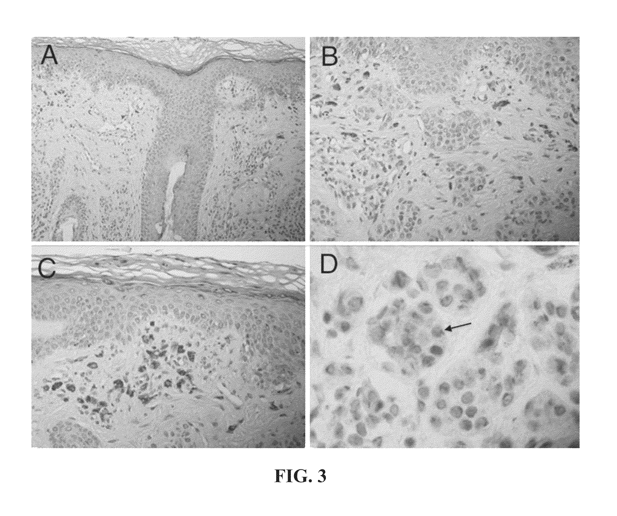 Method for diagnosing melanocytic proliferations